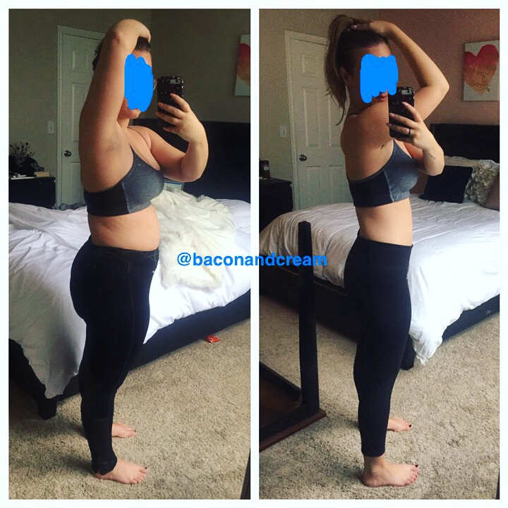 Bacon and Cream Before and After Weight Loss Story